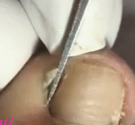 99ACEB365CD9501B39E50A