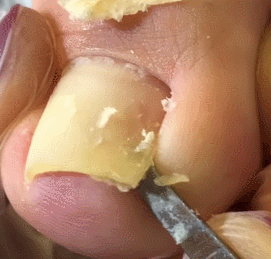 9958573B5CD950280B43CD