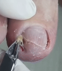 994B933C5CDD45B304D6E0