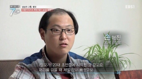 모발이식으로 희망 찾은 30세 청년