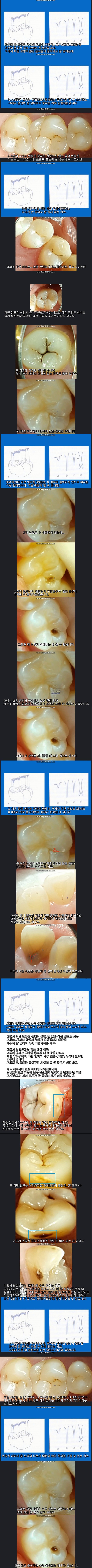 치아는 타고나는 것이 중요