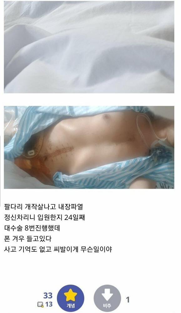 사고로 병원에서 눈 떠보니 24일 지남