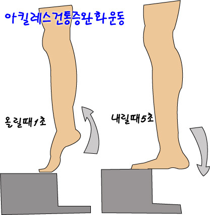 아킬레스건 파열되서 수술하면 뛰지 못하나요?