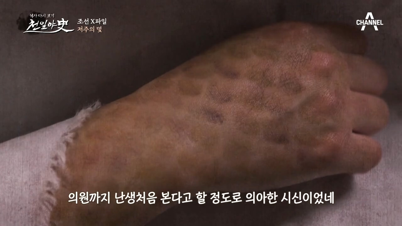 [저주의 진실] 뱀 피부 시신의 정체는 어부에게 살해당한 여인이다?