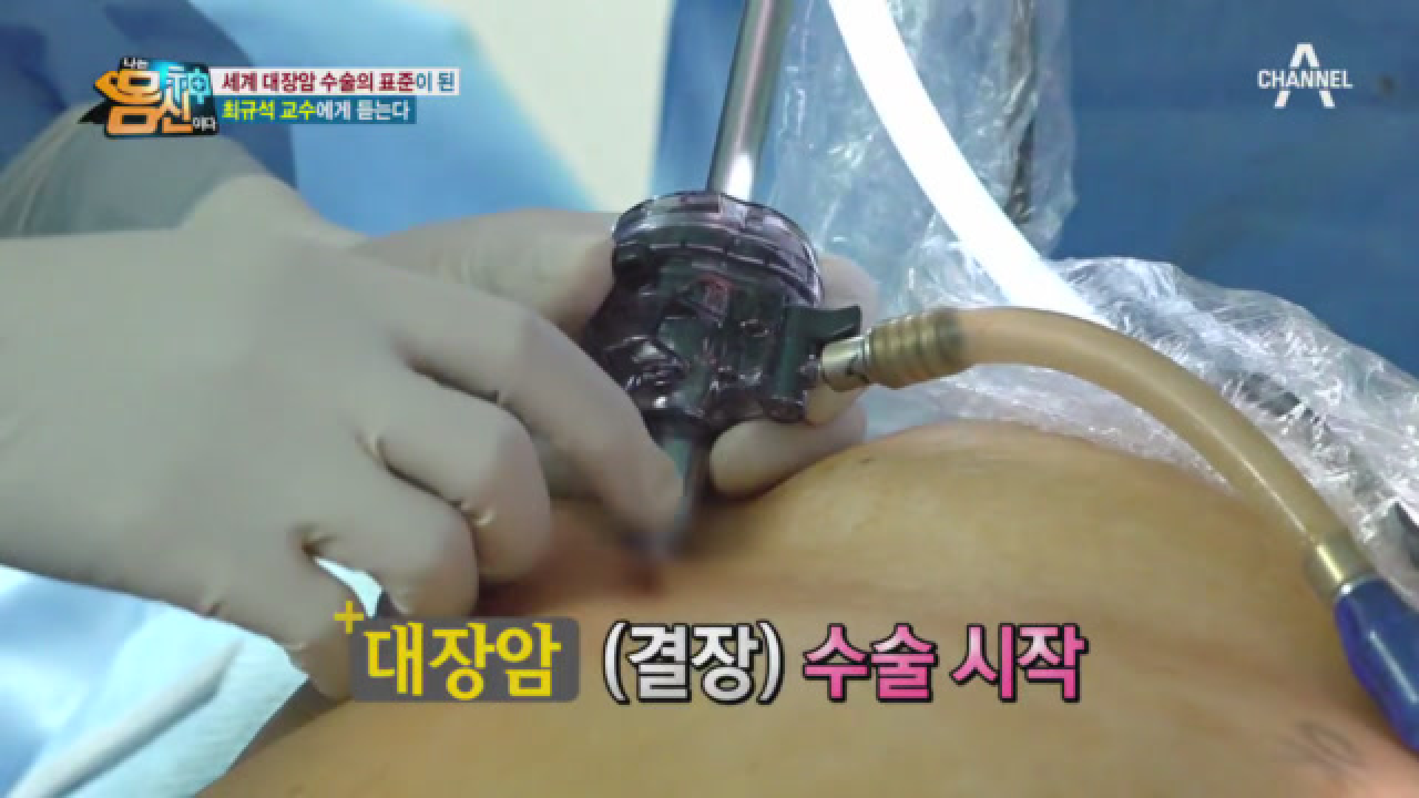 대장암 환자들이 묻는 질문, ＂대장 몇 cm 잘랐습니까?＂