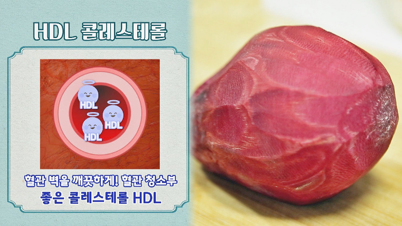 &#39;좋은&#39; 콜레스테롤 높이는 마법의 식재? 레드비트