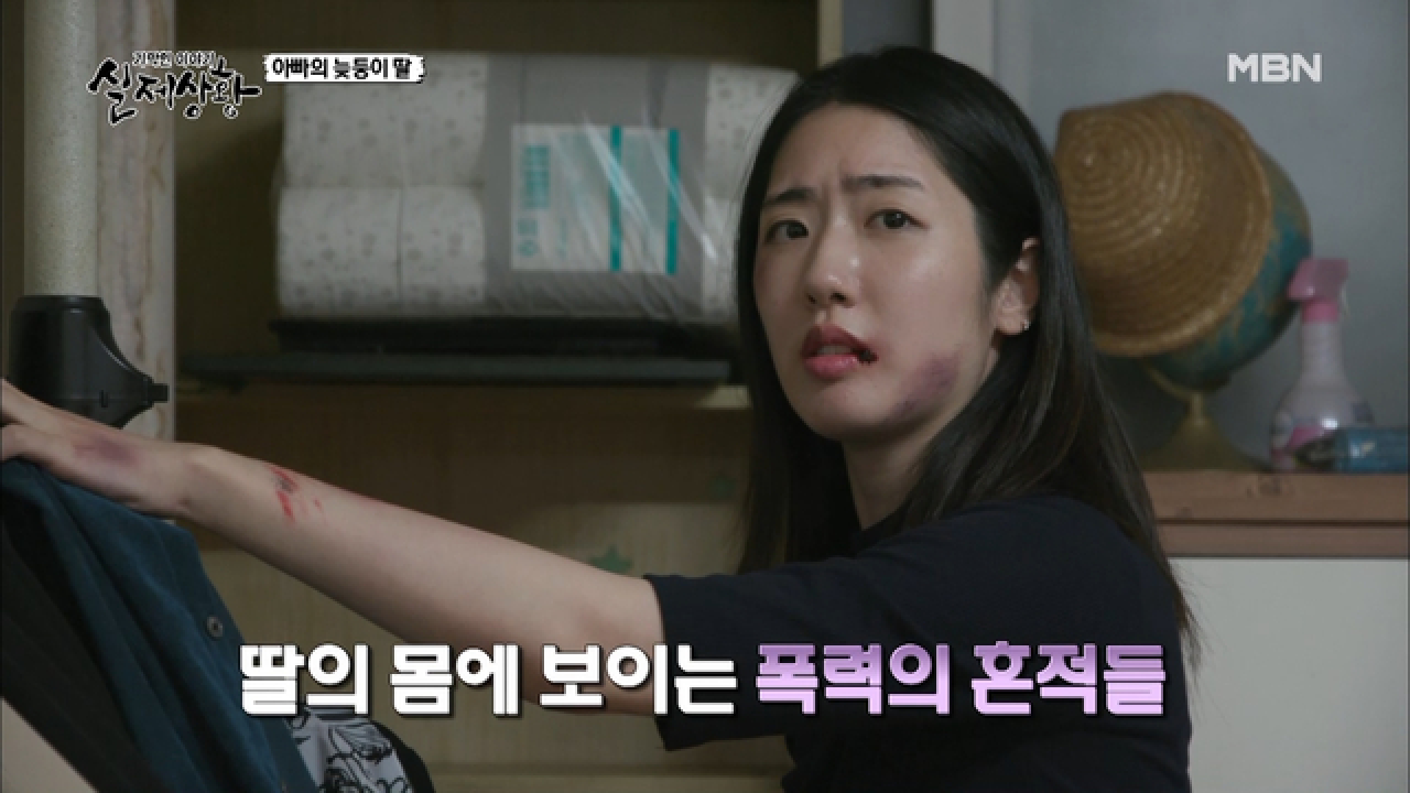 (실제상황) 남자를 만나고 올 때마다 흉터가 생기는 큰딸?!