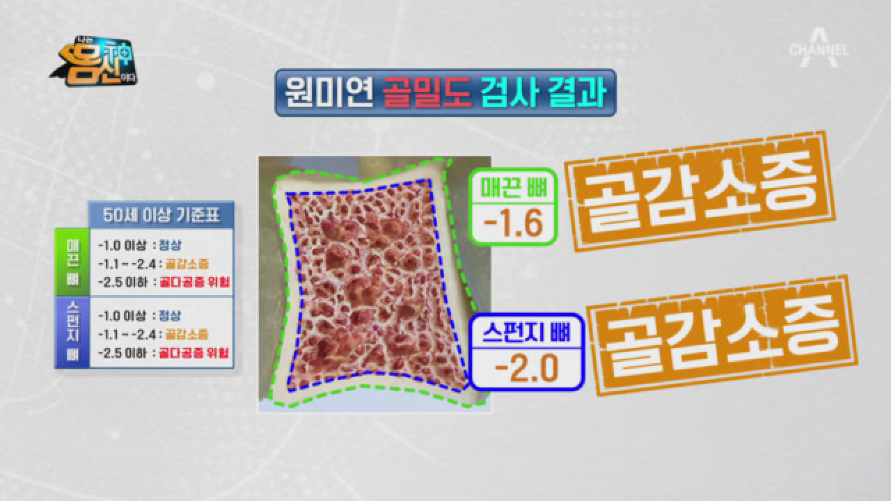 매끈 뼈가 튼튼하지 않았으면 이미 골절? 몸신가족 원미연, 임예진, 이용식의 뼈 상태?
