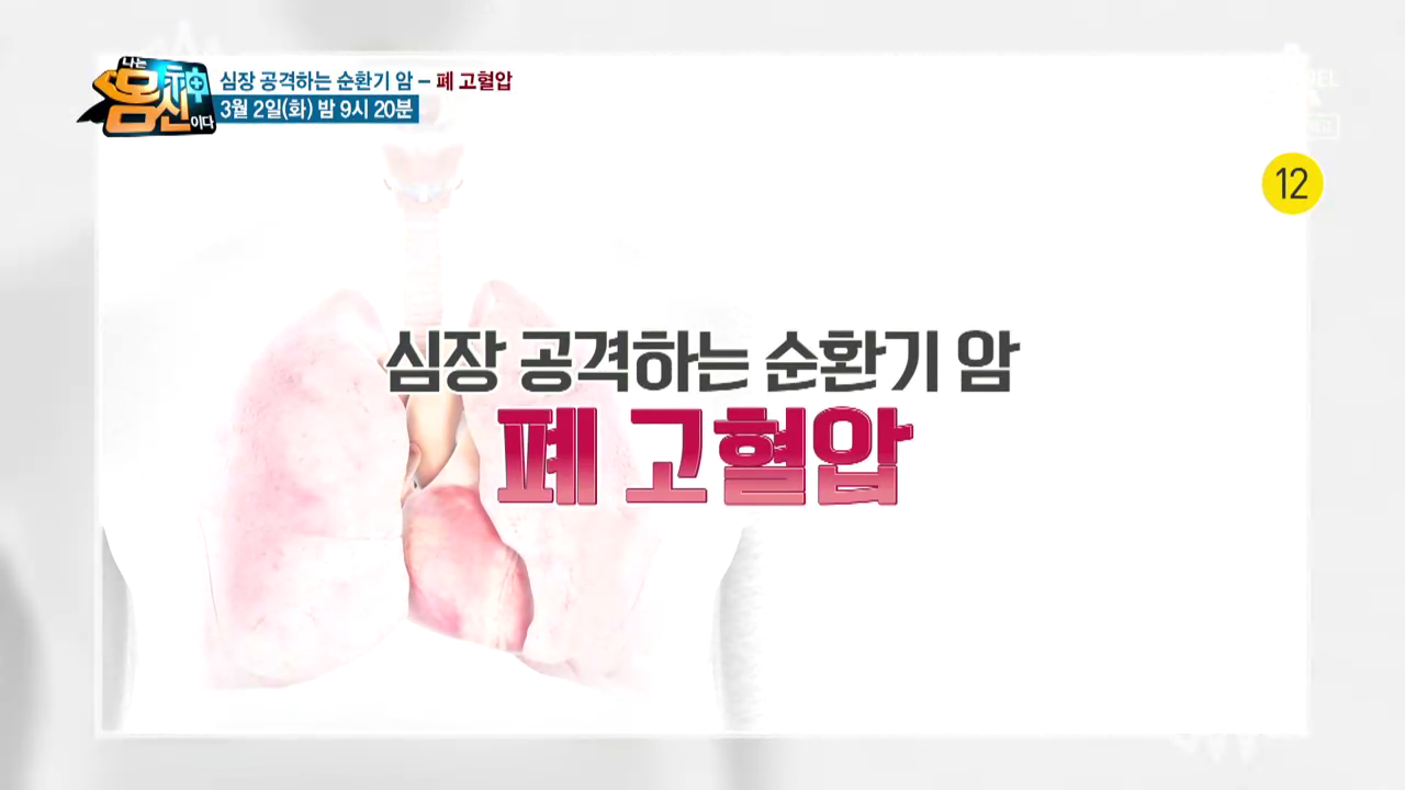 나는 몸신이다 321회