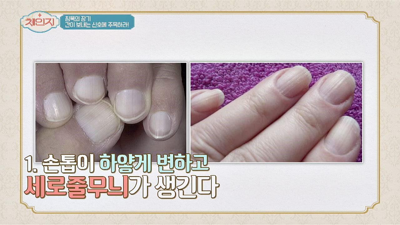 (간이 보내는 신호 ☞) 간 건강 상태 확인하는 방법
