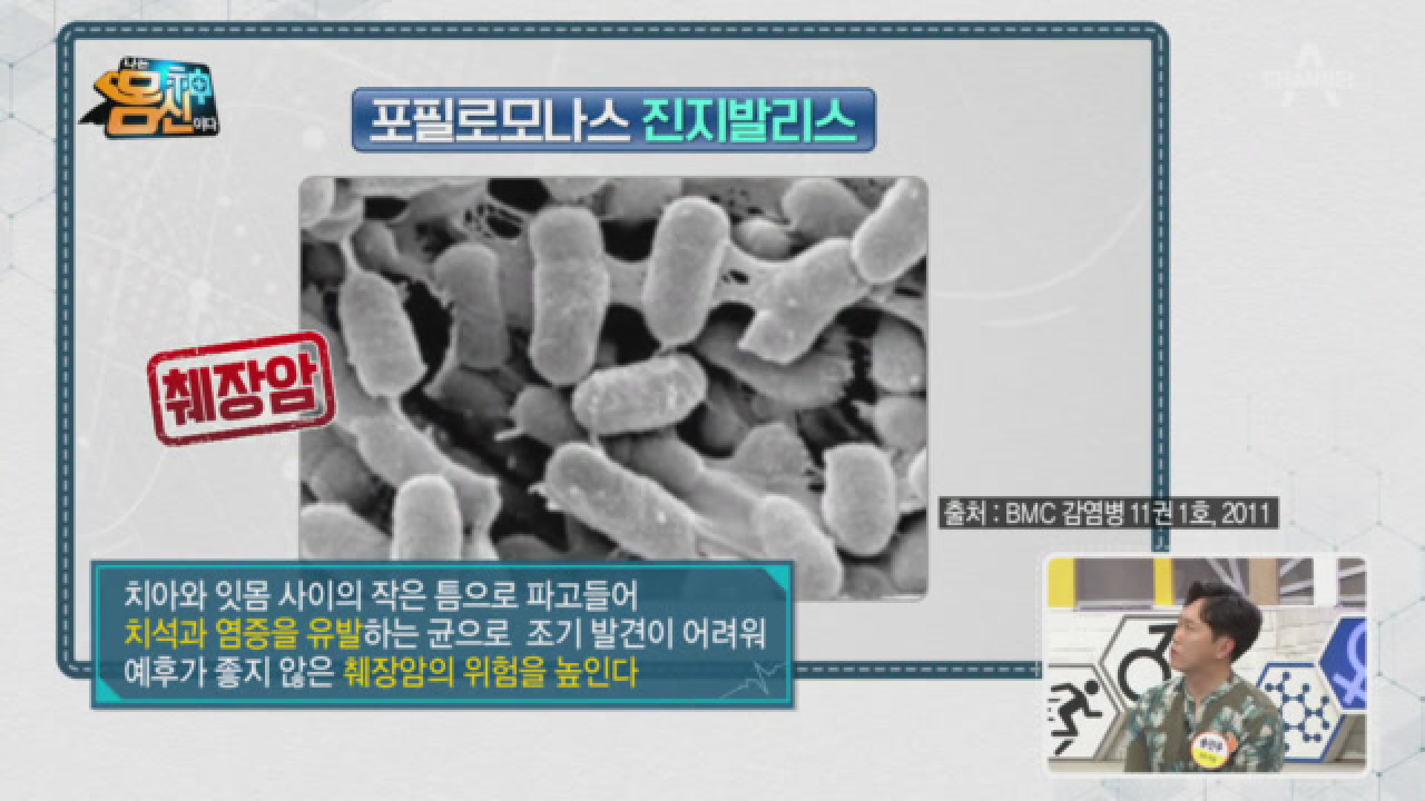 암을 유발하는 입속 세균♨ 전신 건강 위협하는 경고의 시작!