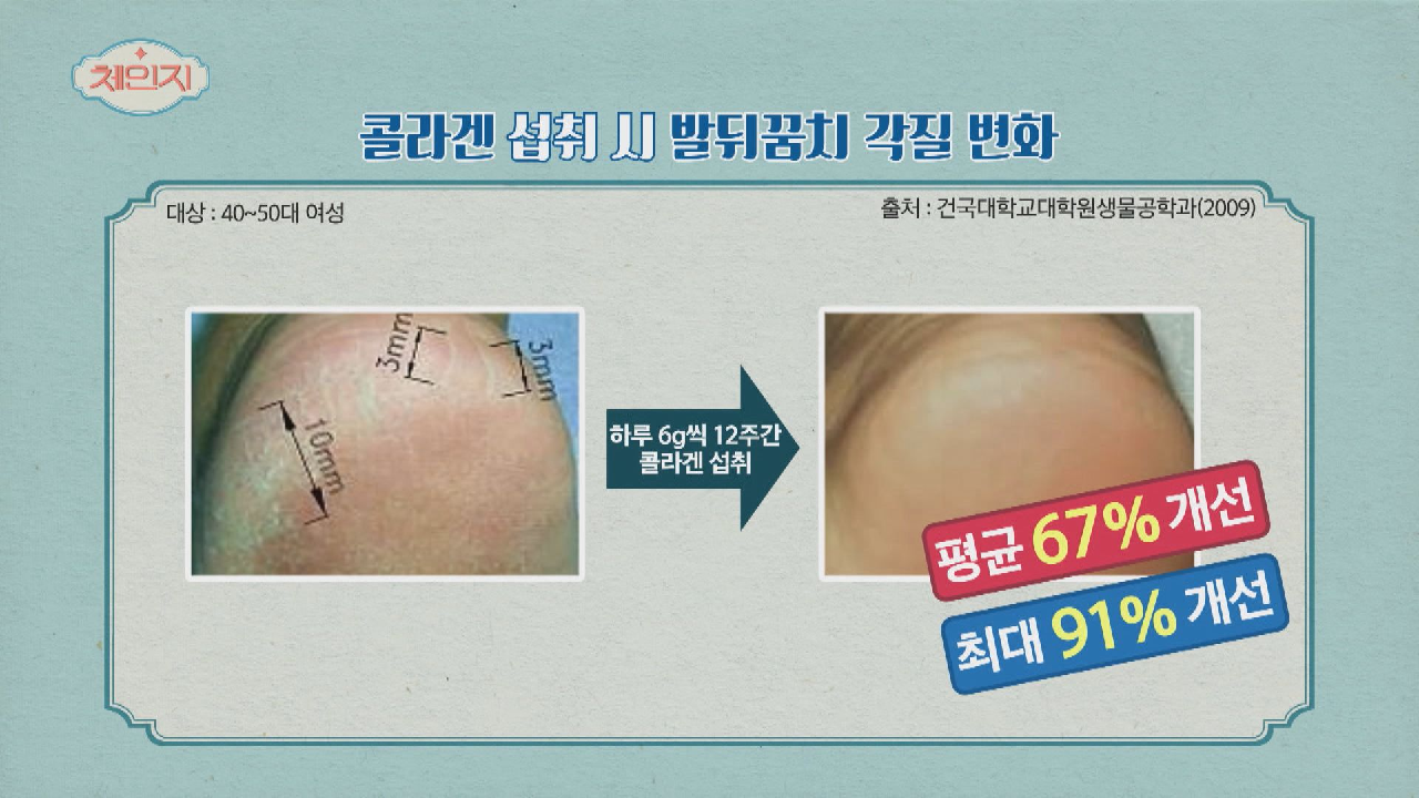 발뒤꿈치 각질??을 잠재운 콜라겐의 놀라운 보습력..!