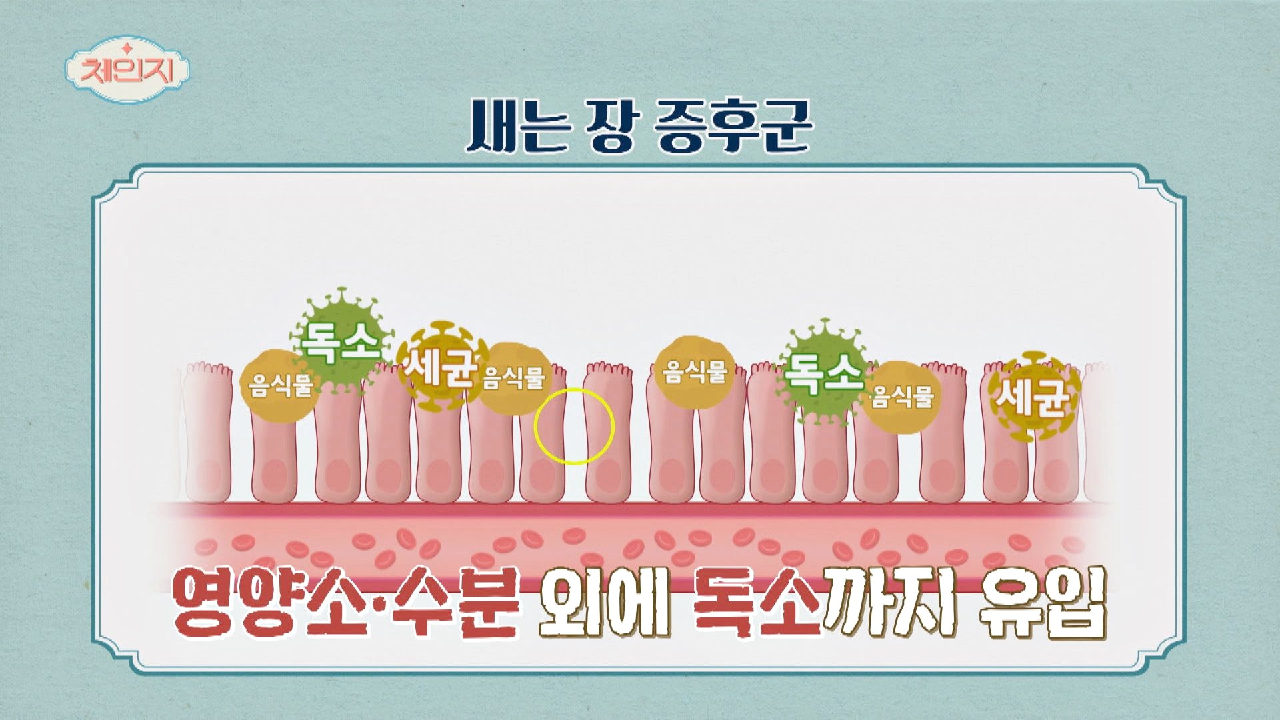 각종 질병의 뿌리가 되는 ☞ 새는 장 증후군 ☜