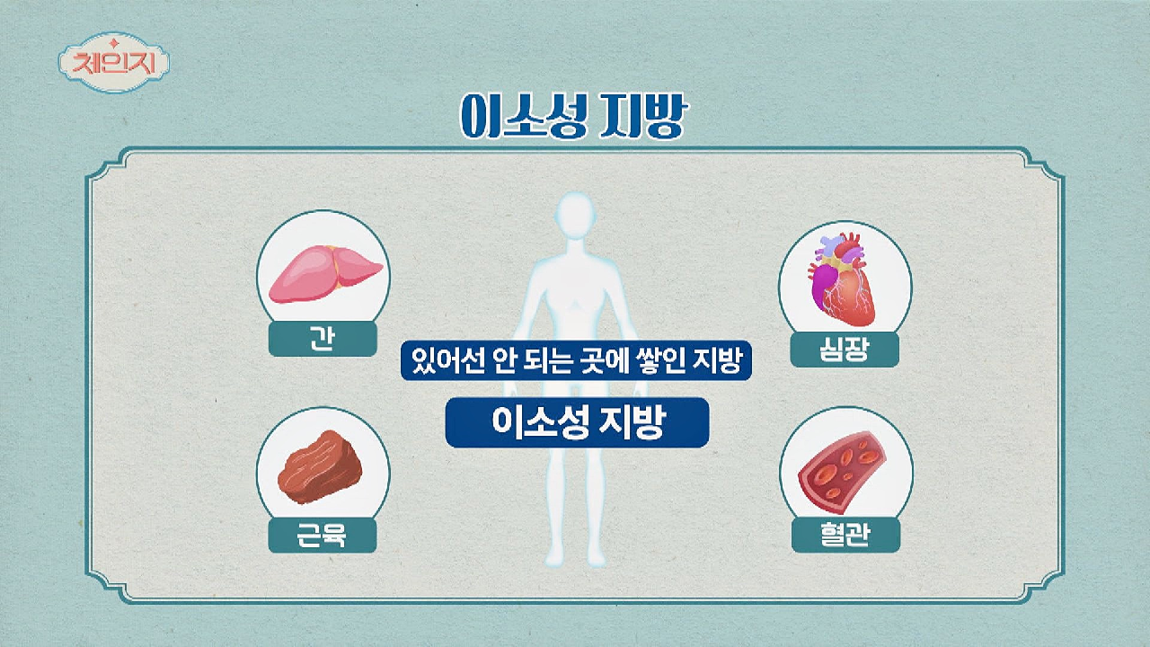 내장 지방보다 더 치명적인 지방! &#39;이소성 지방&#39;