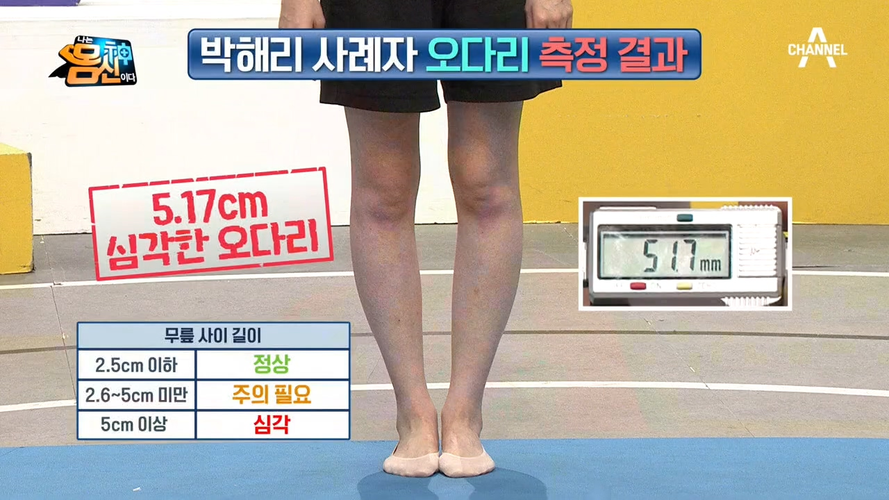 무릎 관절, 근육 강화, 오다리 개선! &#39;페트병&#39; 하나로 해결 가능!