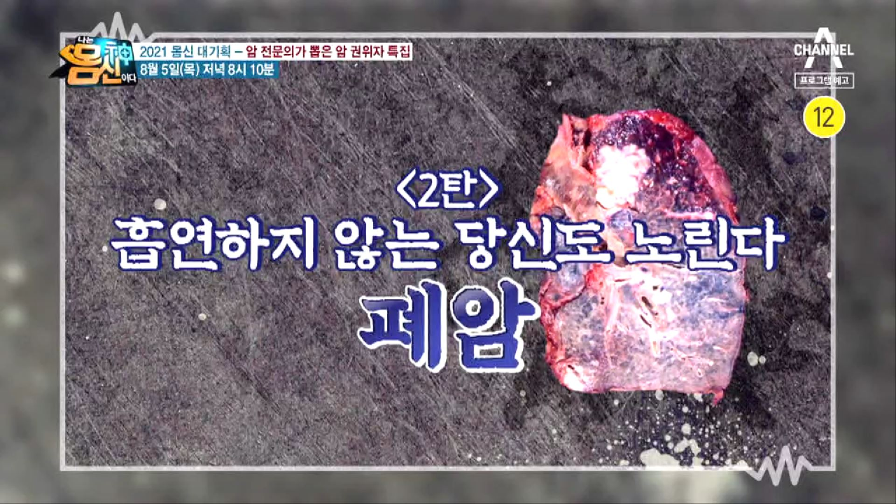 나는 몸신이다 343회