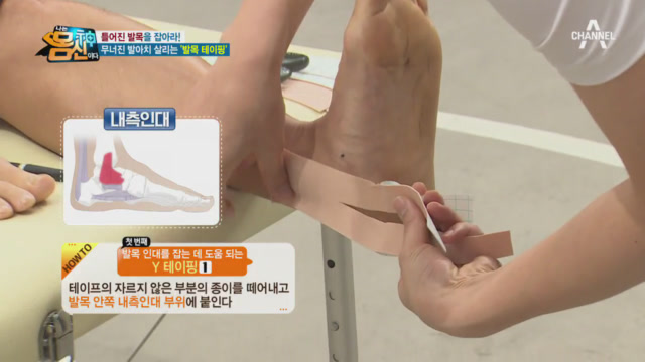 무너진 발아치를 살리는 &#39;발목 테이핑&#39;, 테이프 길이에 따라 달라지는 방법