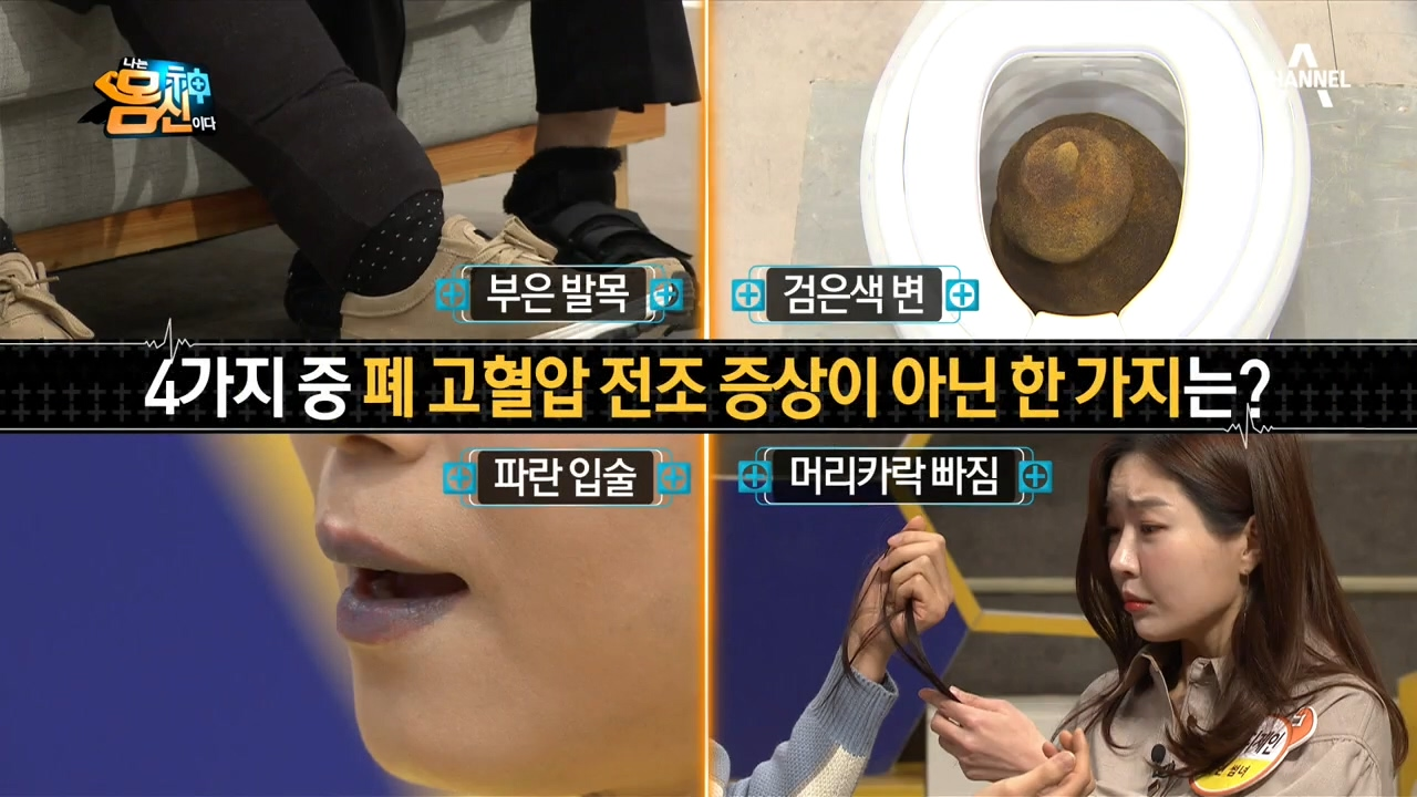 검푸른 입술, 잔뜩 빠지는 머리카락?! 폐 고혈압의 진짜 전조 증상은?