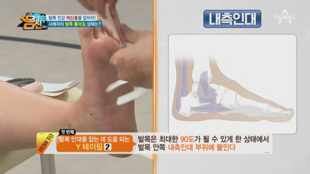 &#39;발등→발바닥→발등&#39;의 테이핑 순서로 틀어진 건강 적신호를 잡다★