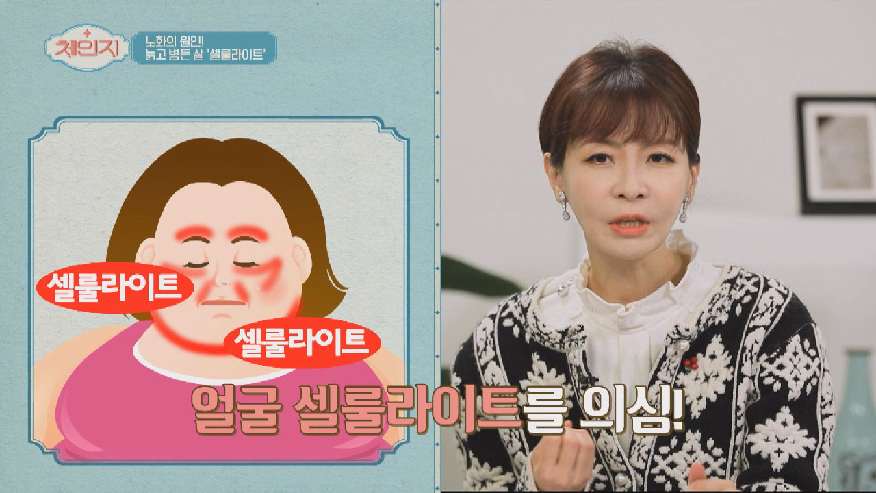 ※충격※ 잘 안 빠지는 얼굴살은? ☞ &#39;얼굴 셀룰라이트&#39;
