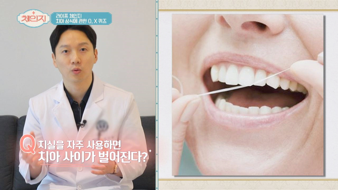 [OX 퀴즈] &#39;치실&#39;을 사용하면 치아 사이가 벌어진다?