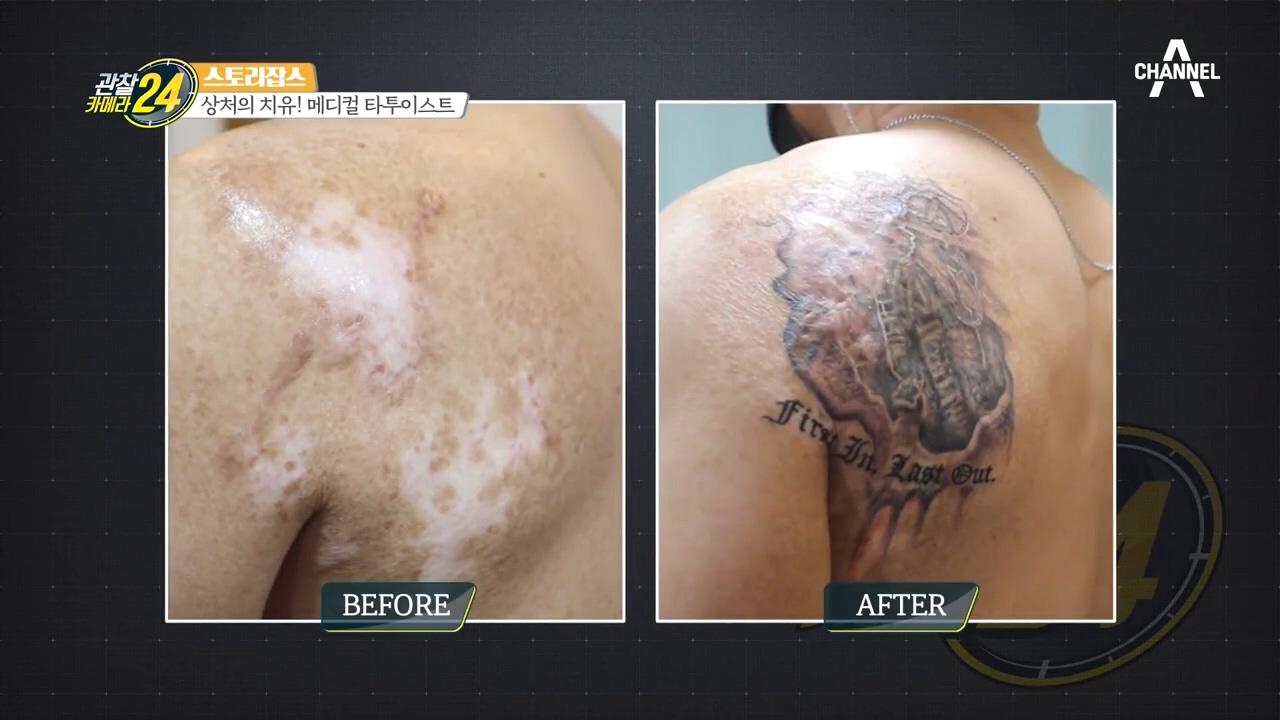 영웅의 몸 속 자리잡은 흉터, '메디컬 타투이스트'의 손에서 예술로 승화되다!