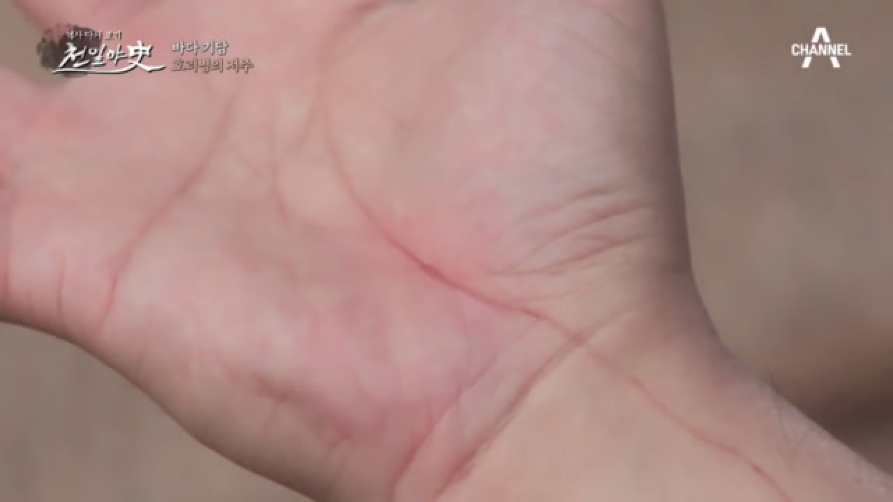 아내의 목숨으로 삶을 연장한 남편(￣□￣)?!