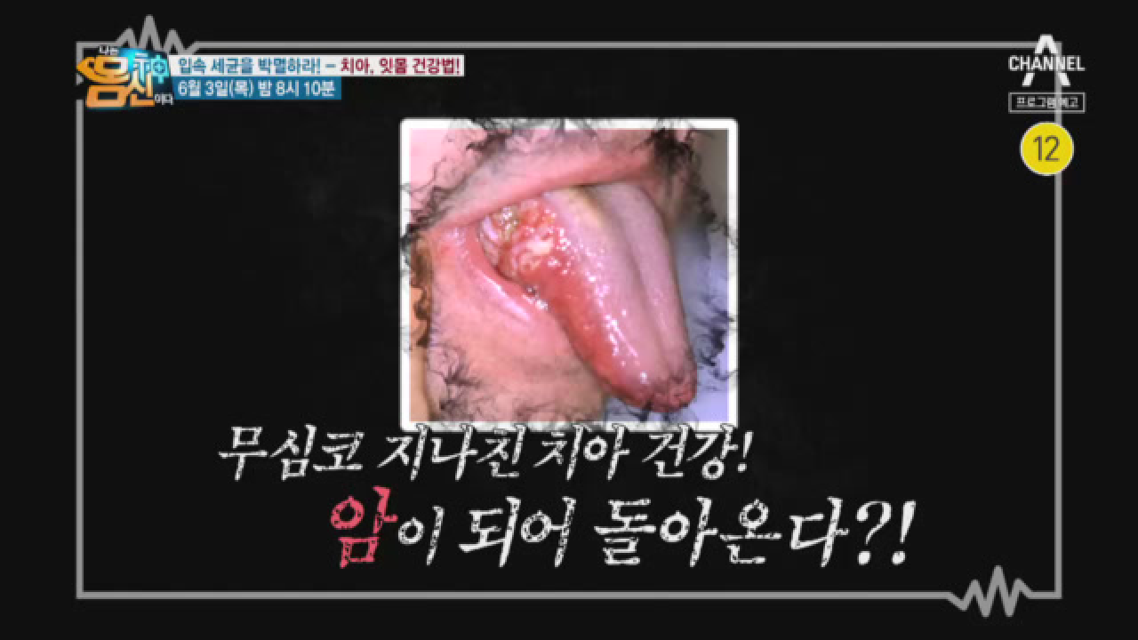 나는 몸신이다 334회