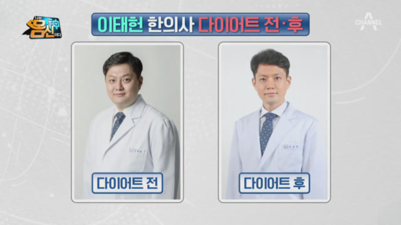 &#39;환자들이 못 알아봐요&#39; 40kg 감량한 한의사의 다이어트 전&amp;후♨