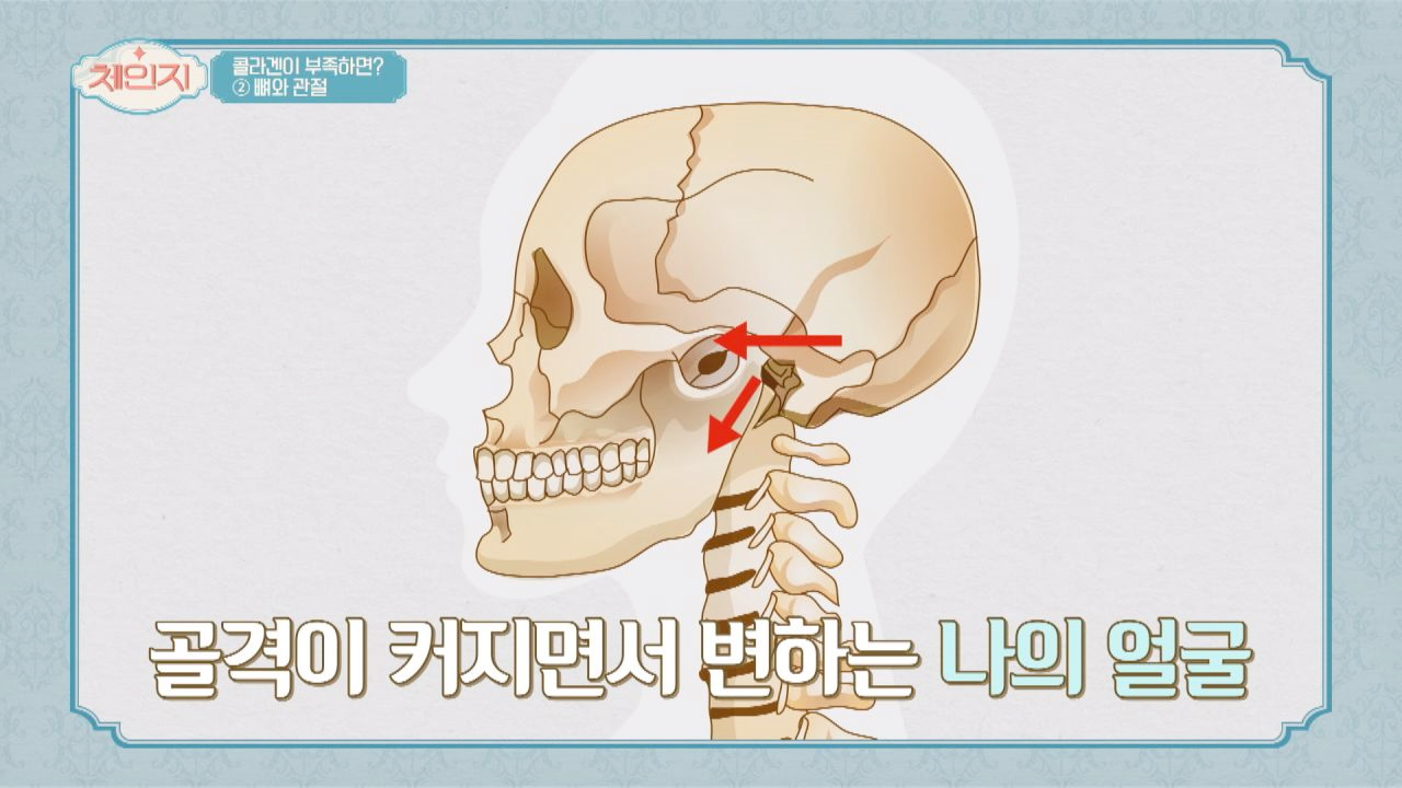 나이 들수록 얼굴이 커지는 이유☞ 콜라겐 부족♨