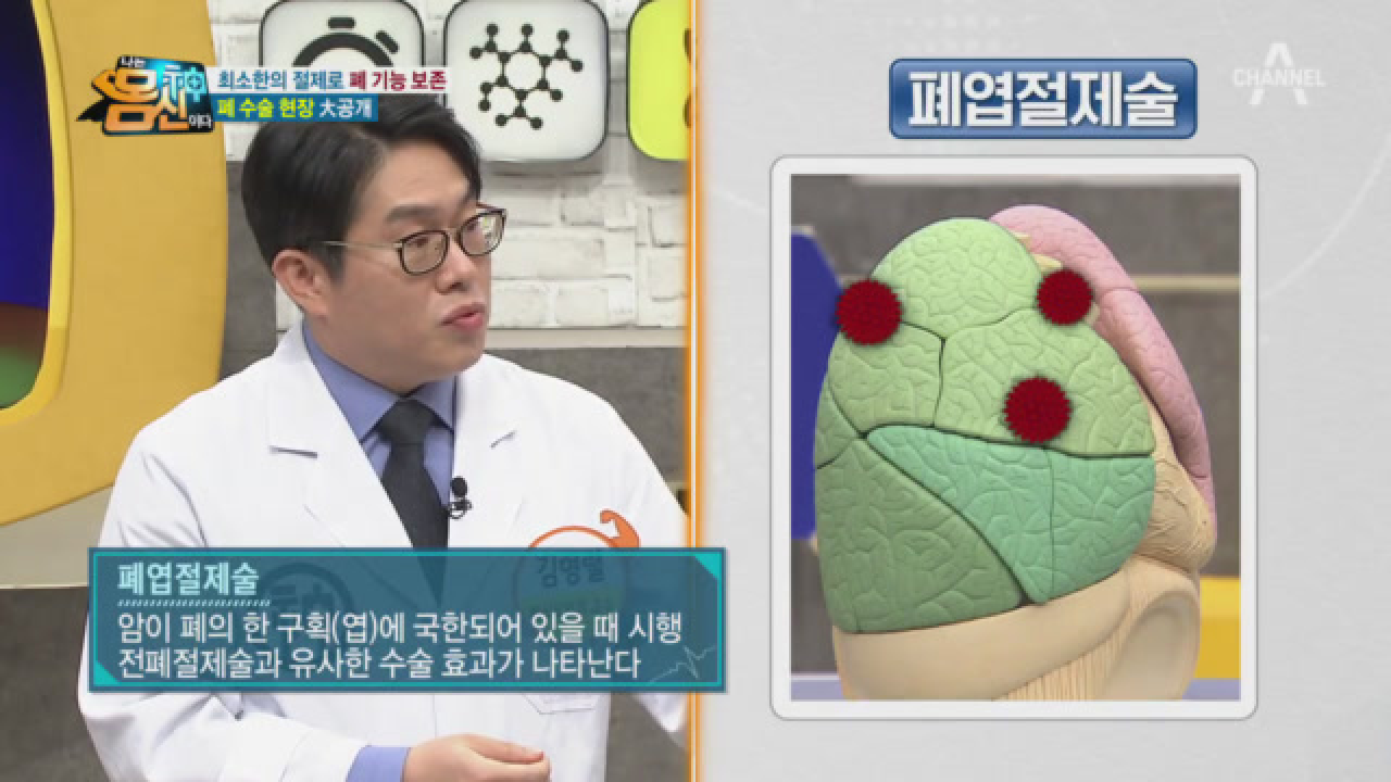 가슴에서 가장 큰 면적을 차지하는 폐, 흉강경 수술로 폐암을 치료하다!