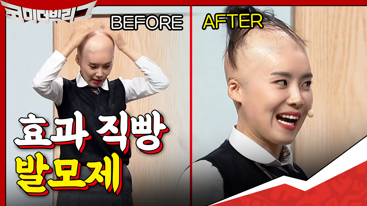 아 두피 타기 전에 선크림 발라야 하는데.. 그냥 발모제를 발라야겠다! ...