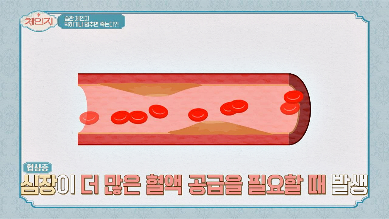 심혈관 질환 &#39;협심증VS심근경색&#39; 차이점은 ◎_◎?