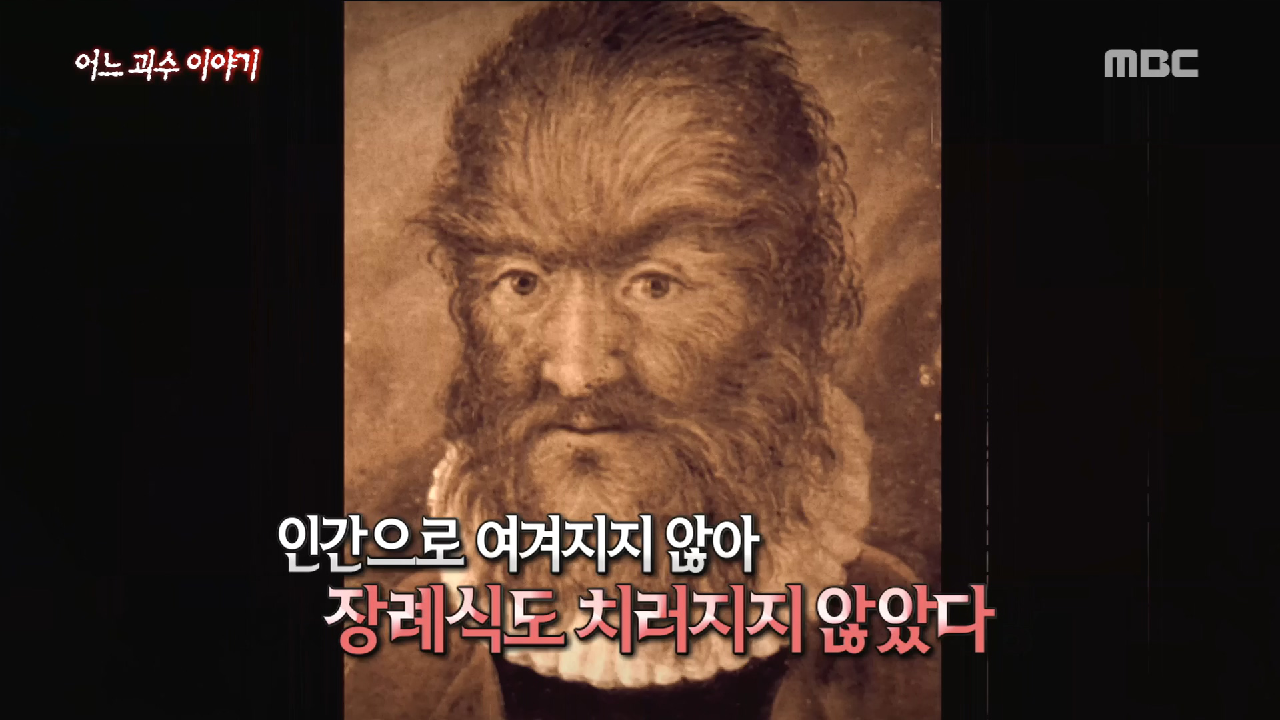 온몸이 털로 뒤덮인 페트루스 곤살 부스 - kakaoTV 온몸이 털로 뒤덮인 페트루스 곤살 부스