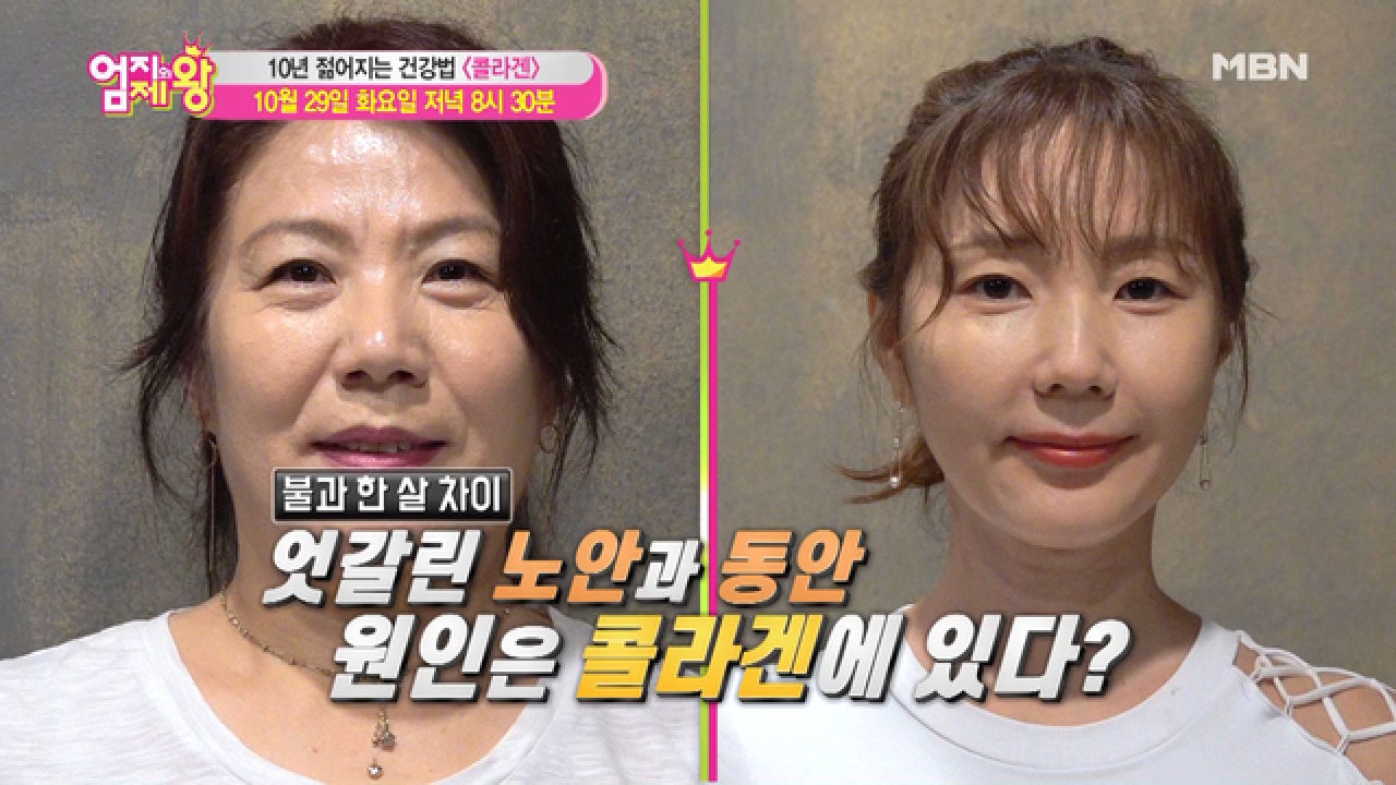 엄지의 제왕 354회 ＜10년 젊어지는 건강법 ＜콜라겐＞＞ - kakaoTV 엄지의 제왕 354회 ＜10년 젊어지는 건강법 ＜콜라겐＞＞