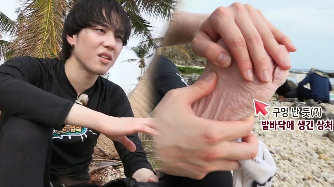 유겸, 생존 강행군 속 아찔한 부상 ‘발바닥 구멍’