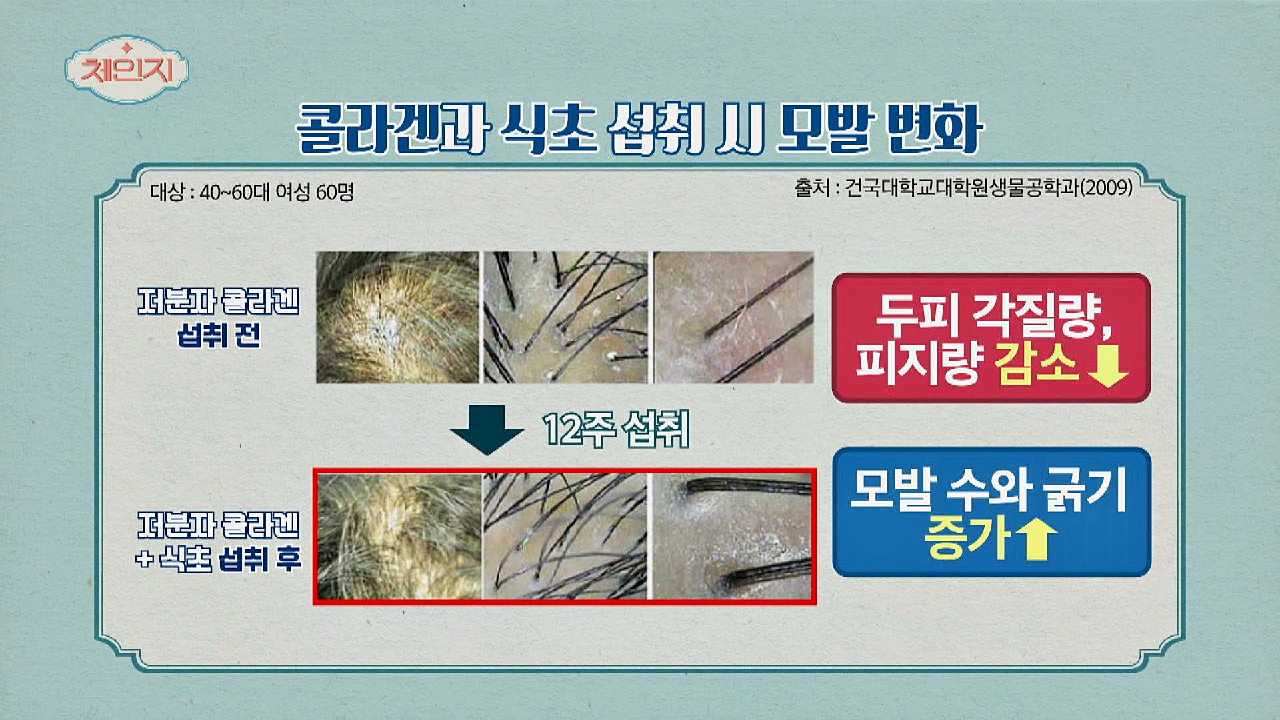 부족한 콜라겐이 두피에 미치는 영향☞ 각질 생성