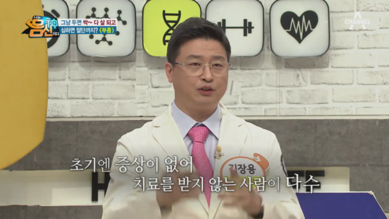 내 다리가 코끼리 같아진다! 하지정맥류와 림프 부종♨