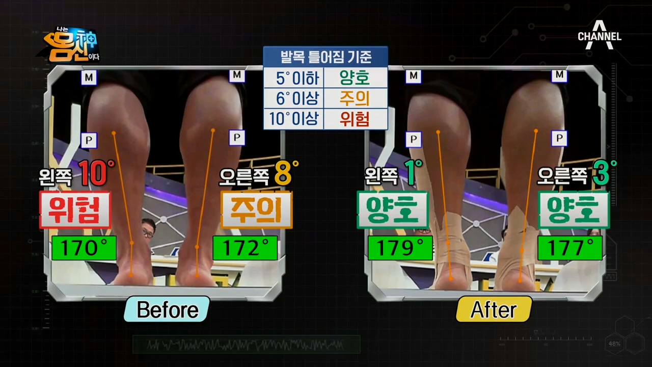 ※발목 틀어짐 완벽 개선※ 무려 30분 만에 &#39;완전 정상&#39;으로 돌아오다!