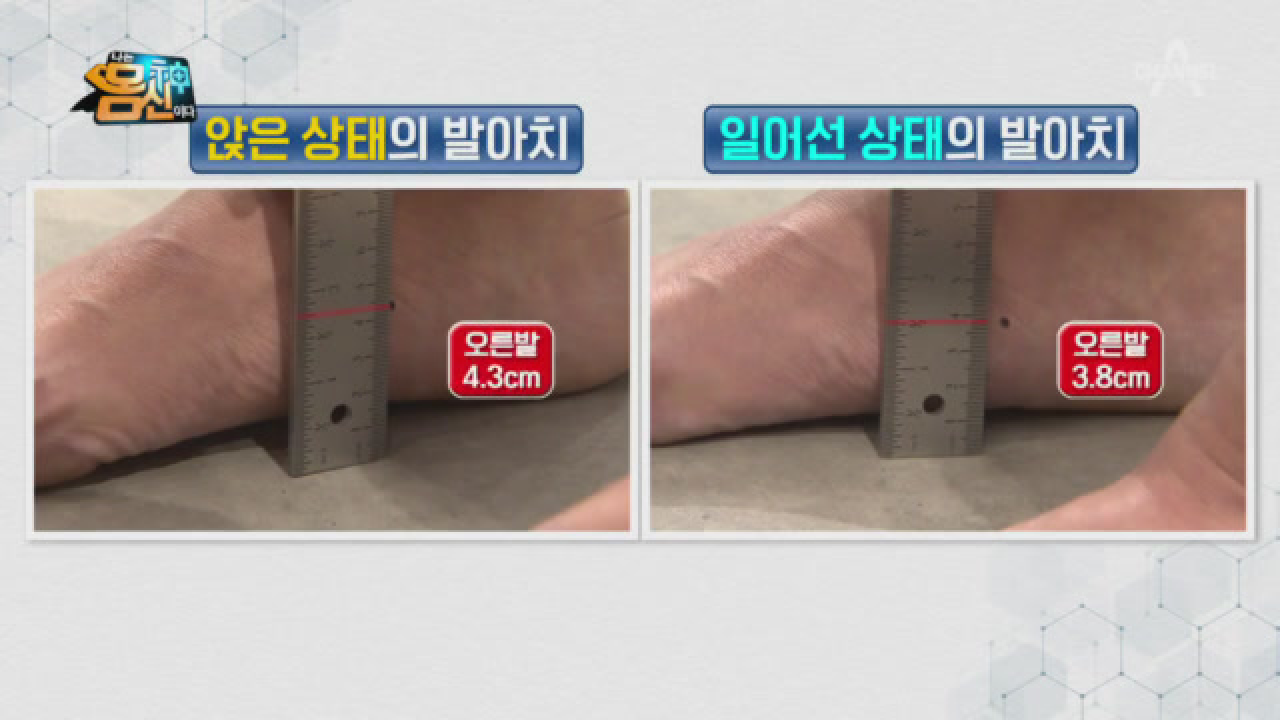 틀어진 발목을 잡아라! 발목 테이핑에 앞서 측정할 &#39;발아치&#39;