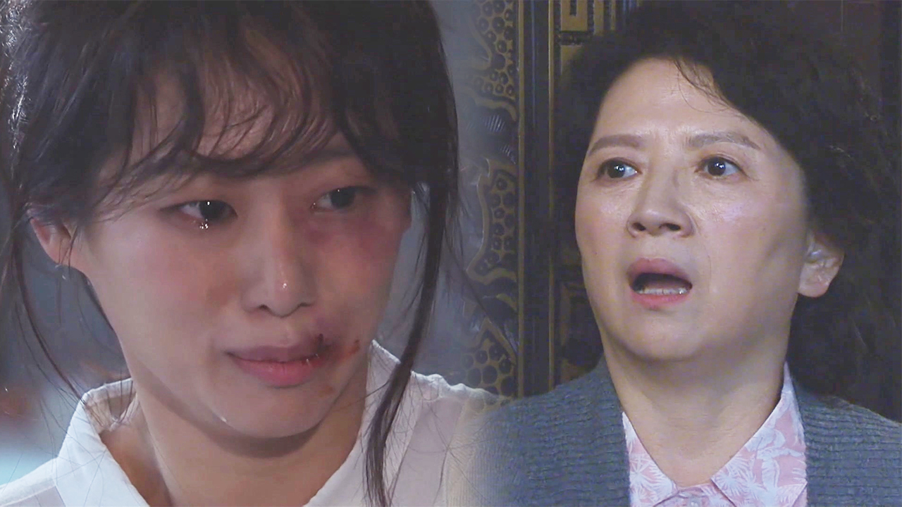 박순천, 현쥬니의 멍든 모습에 충격!