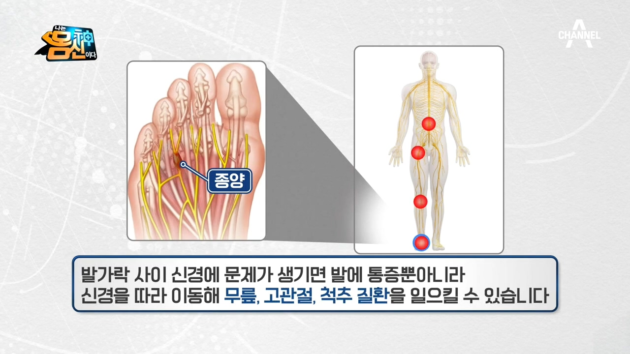 지긋지긋한 전신 관절 통증~♨ 발가락 사이로 잡는다?