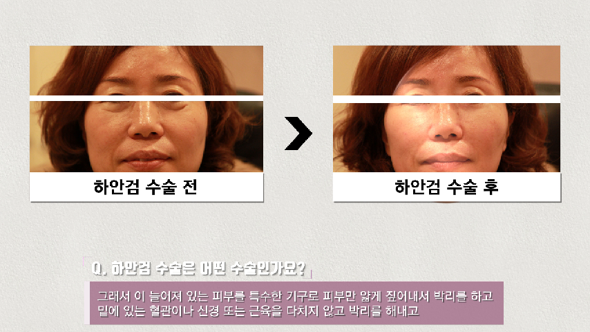 [엔비유의원] 이젠 생기있는 눈으로 변신할 때 - kakaoTV [엔비유의원] 이젠 생기있는 눈으로 변신할 때