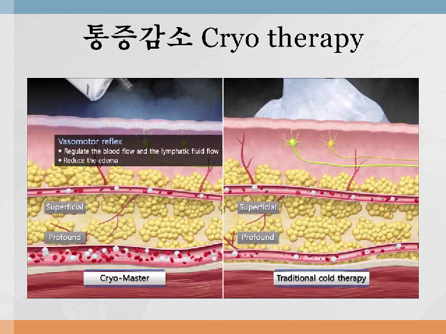 통증의왕 대상포진.....그랜드연합의원에서는 피부과와 통증클리닉을 함께 진료가능해서 대상포진전문치료가 가능합 - kakaoTV 통증의왕... 