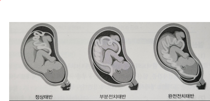 기초간호학(모성간호학) 임신5 - 교육자료(간호조무사) - 천안베스트간호학원 / 부설요양보호사교육원