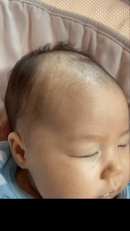 👶숨 쉬는 아기 머리(대천문).gif | 인스티즈