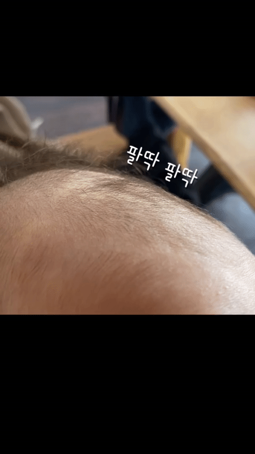 👶숨 쉬는 아기 머리(대천문).gif | 인스티즈