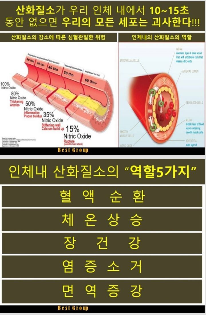 산화 이미지