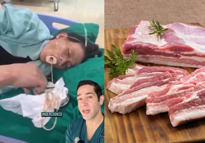 고기 이미지