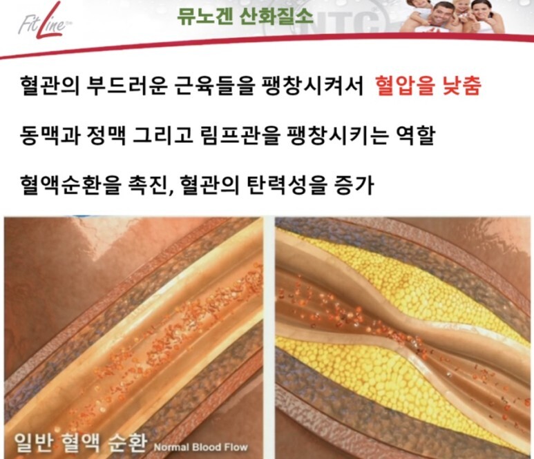 산화 이미지